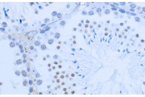 Immunohistochemistry of paraffin-embedded Mouse testis using DiMethyl-Histone H3-K36 Polyclonal Antibody at dilution of 1:200 (40x lens).