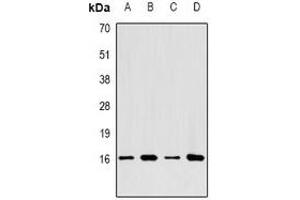 Western blot analysis of LC3A expression in SHSY5Y (A), HepG2 (B), BT474 (C), mouse brain (D) whole cell lysates. (MAP1LC3A anticorps)