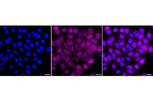 anti-NUF2, NDC80 Kinetochore Complex Component (NUF2) antibody
