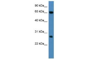 WB Suggested Anti-KBTBD8 Antibody Titration: 0. (KBTBD8 anticorps  (N-Term))