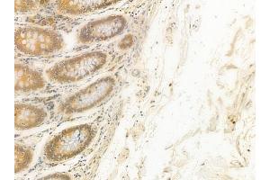 anti-DMRT-Like Family C2 (DMRTC2) (N-Term) antibody