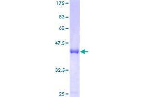 Image no. 1 for Centromere Protein M (CENPM) (AA 1-180) protein (GST tag) (ABIN1349126)