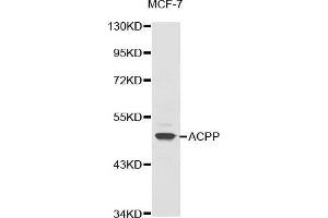 Western blot analysis of extracts of MCF-7 cell line, using ACPP antibody. (ACPP anticorps  (AA 40-300))