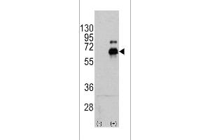 Western blot analysis of RPS6KB1 using rabbit polyclonal RPS6KB1 Antibody (S424) using 293 cell lysates (2 ug/lane) either nontransfected (Lane 1) or transiently transfected with the RPS6KB1 gene (Lane 2).