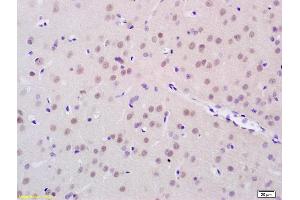 Formalin-fixed and paraffin embedded rat brain tissue labeled with Anti-FTO/Protein Fatso Polyclonal Antibody, Unconjugated (ABIN872957) at 1:200 followed by conjugation to the secondary antibody (FTO anticorps  (AA 165-265))