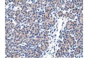 Image no. 2 for anti-Leucine Carboxyl Methyltransferase 1 (LCMT1) antibody (ABIN1499107) (LCMT1 anticorps)