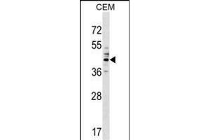 CEAC Antibody (Center) (ABIN1537994 and ABIN2849399) western blot analysis in CEM cell line lysates (35 μg/lane). (CEACAM6 anticorps  (AA 188-214))