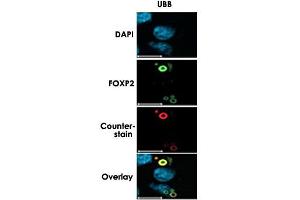 Characterization of FOXP2 Isoforms. (Ubiquitin B anticorps  (C-Term))