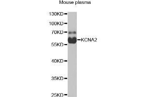 Western blot analysis of extracts of mouse plasma, using KCNA2 antibody (ABIN1980311) at 1:1000 dilution.