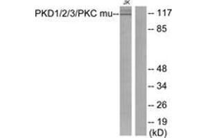 Western blot analysis of extracts from Jurkat cells, using PKD1/2/3/PKC mu (Ab-744/748) Antibody. (PKD1/2/3/PKC mu (AA 706-755) anticorps)