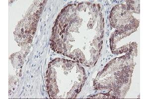 Image no. 14 for anti-Interferon Regulatory Factor 6 (IRF6) antibody (ABIN1498901)