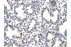 FLJ12529 antibody was used for immunohistochemistry at a concentration of 4-8 ug/ml to stain Alveolar cells (arrows) in Human Lung. (CPSF7 anticorps  (C-Term))