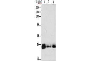 Western Blotting (WB) image for anti-RAB6A, Member RAS Oncogene Family (RAB6A) antibody (ABIN2425552) (RAB6A anticorps)