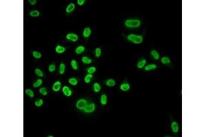 Immunofluorescence analysis of U2OS cells using MCM6 antibody.
