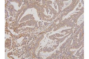 IHC analysis of RAB3GAP2 using anti-RAB3GAP2 antibody (ABIN6719633). (RAB3GAP2 anticorps  (AA 1-115))