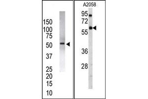 Image no. 2 for anti-Ubiquitin Specific Peptidase 14 (USP14) (N-Term) antibody (ABIN357546)