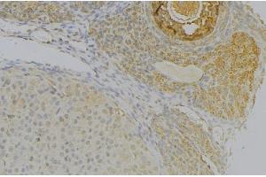 ABIN6277291 at 1/100 staining Human uterus tissue by IHC-P. (NRP2 anticorps  (N-Term))