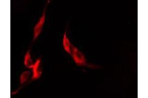 ABIN6274431 staining COLO205 cells by IF/ICC. (PPHLN1 anticorps  (N-Term))