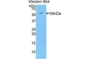 Western Blotting (WB) image for anti-Perforin 1 (Pore Forming Protein) (PRF1) (AA 32-316) antibody (ABIN1860311) (Perforin 1 anticorps  (AA 32-316))