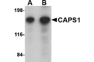 Western Blotting (WB) image for anti-Ca++-Dependent Secretion Activator (CADPS) (N-Term) antibody (ABIN1031290) (CADPS anticorps  (N-Term))