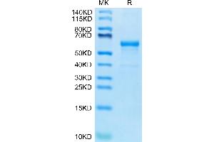 Human CDH17 Domain 6-7 on Tris-Bis PAGE under reduced condition. (LI Cadherin Protein (AA 567-777) (Fc Tag))