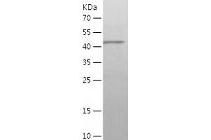 Western Blotting (WB) image for gamma-aminobutyric Acid (GABA) A Receptor, alpha 1 (GABRA1) (AA 28-236) protein (His-IF2DI Tag) (ABIN7123050)