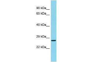 Host: Rabbit Target Name: C22orf13 Sample Type: Fetal Liver lysates Antibody Dilution: 1. (C22orf13 anticorps  (C-Term))