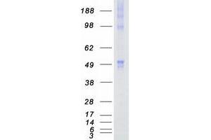 Validation with Western Blot