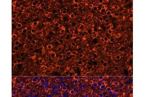 Immunofluorescence analysis of Mouse brain using TUBB3 Polyclonal Antibody at dilution of 1:100. (TUBB3 anticorps)