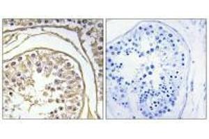 Immunohistochemistry analysis of paraffin-embedded human testis tissue using BAGE2 antibody. (BAGE2 anticorps)