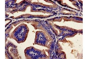 Immunohistochemistry analysis of human prostate tissue using ABIN7174228 at dilution of 1:100