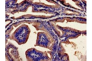 Immunohistochemistry analysis of human prostate tissue using ABIN7174228 at dilution of 1:100 (Ubiquilin 2 anticorps  (AA 473-542))