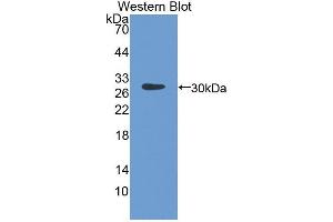 Detection of Recombinant NCF4, Mouse using Polyclonal Antibody to Neutrophil Cytosolic Factor 4 (NCF4)