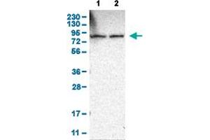 Western Blot analysis of (1) human cell line RT-4, and (2) human cell line U-251MG sp. (THOC1 anticorps  (AA 154-240))