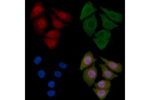 ABIN6259232 and ABIN6275659 staining Hela cells by IF/ICC. (USP45 anticorps  (Internal Region))