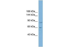WB Suggested Anti-MGC16169 Antibody Titration:  0. (TBCK anticorps  (Middle Region))