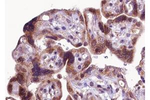 ABIN6267368 at 1/100 staining human Placenta tissue sections by IHC-P. (FGFR1 anticorps  (pTyr766))