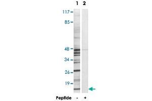 Western blot analysis of extracts from K-562 cells, using MRPS18C polyclonal antibody . (MRPS18C anticorps)