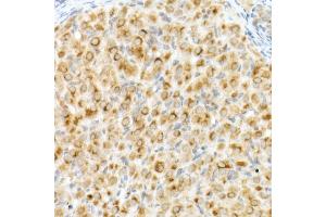 Immunohistochemistry of paraffin-embedded rat ovary using Cation-independent M6PR (IGF2R) antibody (ABIN7267905) at dilution of 1:200 (40x lens). (IGF2R anticorps)