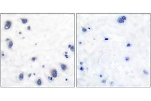 Immunohistochemistry analysis of paraffin-embedded human brain tissue, using Tyrosine Hydroxylase (Ab-40) Antibody.