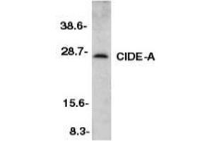 Western blot analysis of CIDE-A in mouse heart tissue lysate with AP30230PU-N CIDE-A antibody at 1/500 dilution. (CIDEA anticorps  (C-Term))