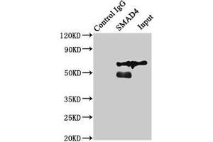 Immunoprecipitating SMAD4 in Jurkat whole cell lysate Lane 1: Rabbit control IgG (1 μg) instead of ABIN7160238 in Jurkat whole cell lysate. (SMAD4 anticorps  (AA 27-195))