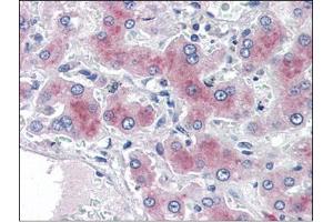 Human Liver (formalin-fixed, paraffin-embedded) stained with PCK1at 2 µg/ml followed by biotinylated anti-goat IgG secondary antibody, alkaline phosphatase-streptavidin and chromogen. (PCK1 anticorps  (Internal Region))