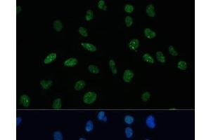 Immunofluorescence analysis of U-2 OS cells using MKL1 Polyclonal Antibody at dilution of 1:100 (40x lens). (MKL1 anticorps)