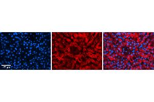 Rabbit Anti-FKBP8 Antibody Catalog Number: ARP46862_P050 Formalin Fixed Paraffin Embedded Tissue: Human Liver Tissue Observed Staining: Cytoplasm in hepatocytes Primary Antibody Concentration: 1:100 Other Working Concentrations: N/A Secondary Antibody: Donkey anti-Rabbit-Cy3 Secondary Antibody Concentration: 1:200 Magnification: 20X Exposure Time: 0.