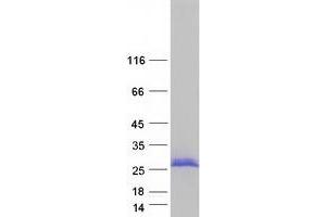 Validation with Western Blot