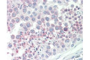 Anti-IGFBP1 antibody IHC staining of human testis. (IGFBPI anticorps  (AA 156-170))