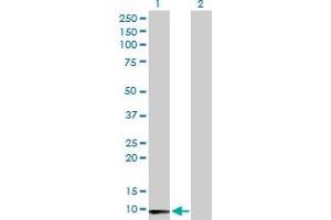 Western Blot analysis of LY6E expression in transfected 293T cell line by LY6E MaxPab polyclonal antibody.