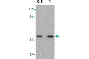 Western blot analysis of SKIL in A-431 cell lysate with SKIL polyclonal antibody  at 0. (SKIL anticorps  (N-Term))