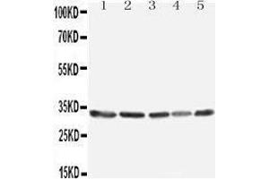 Western Blotting (WB) image for anti-Tumor Necrosis Factor, alpha-Induced Protein 8-Like 3 (TNFAIP8L3) (AA 273-292), (C-Term) antibody (ABIN3042574) (TNFAIP8L3 anticorps  (C-Term))